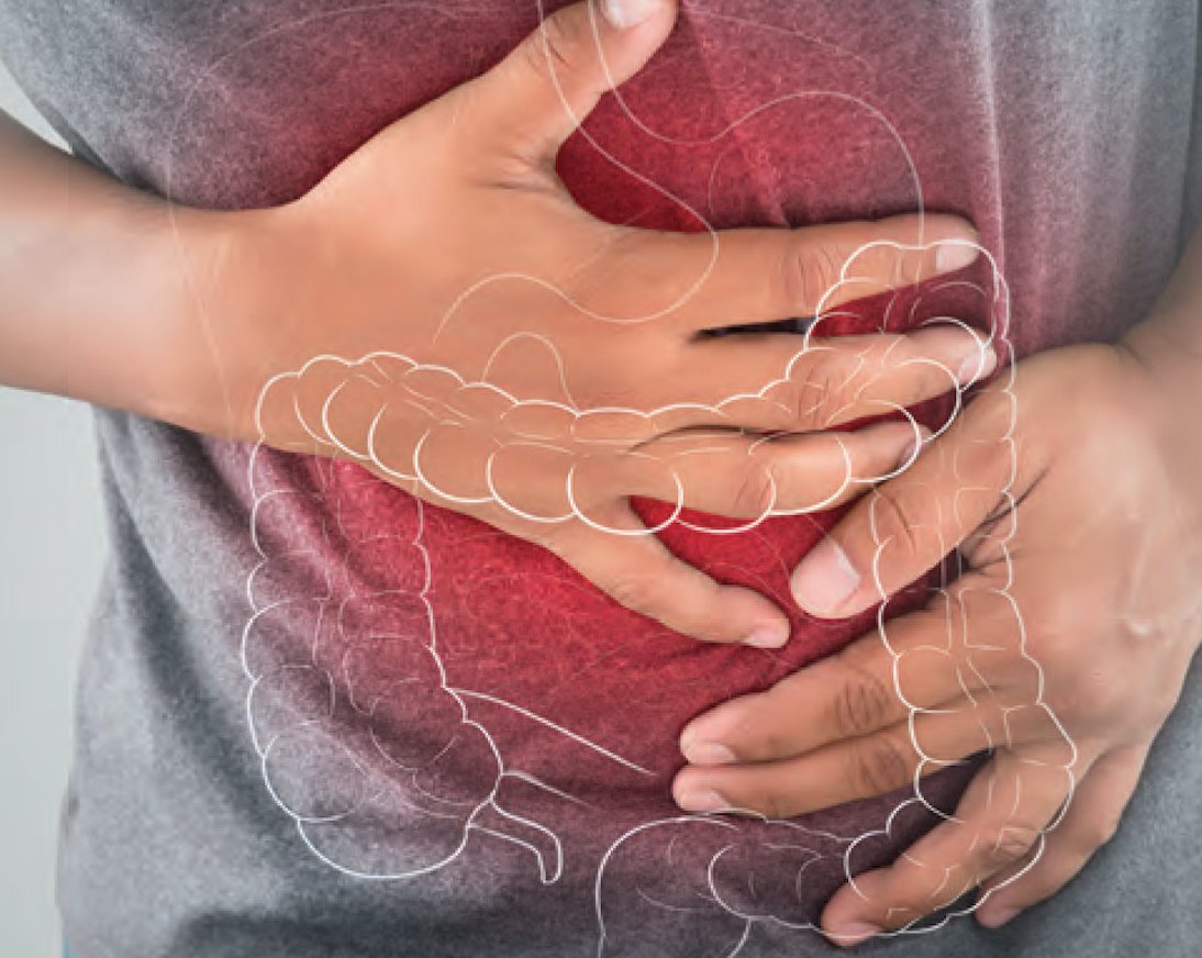 Инфекция Сlostridium difficile